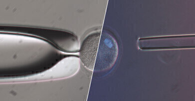 True-to-Life - Olympus IVF Solutions